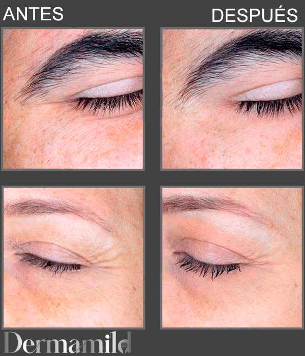 Kit Dermamild Skin Renewal — Ciencia suave para una piel más firme y luminosa